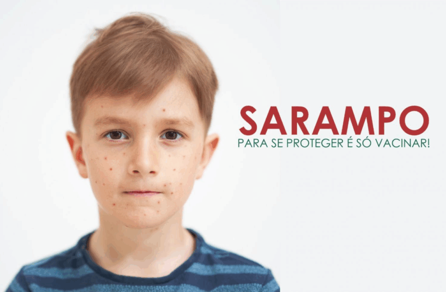 Estado reforça importância da vacinação de sarampo por risco de reintrodução da doença