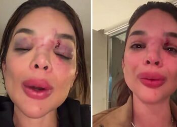 Fantástico exibe câmera de segurança flagrando agressão a dentista por empresário da Faria Lima: “Tentou me m*tar”