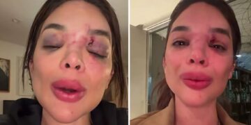 Fantástico exibe câmera de segurança flagrando agressão a dentista por empresário da Faria Lima: “Tentou me m*tar”